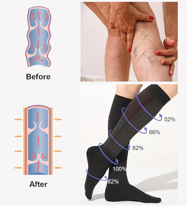2 Pairs Medical Compression Socks for Women & Men 20-30 mmHg, class 2, Best Graduated Stockings Support Fit for Travel Flight Running Varicose Veins Pregnancy Nurses (Black+Beige, XL)